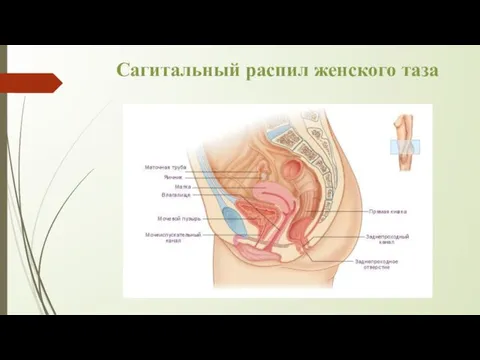 Сагитальный распил женского таза