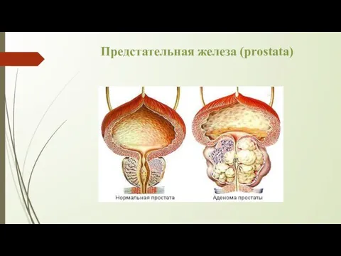 Предстательная железа (prostata)