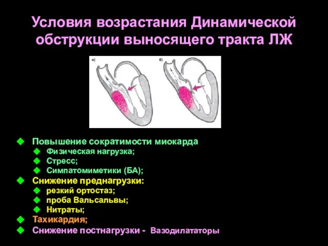 Условия возрастания Динамической обструкции выносящего тракта ЛЖ Повышение сократимости миокарда Физическая