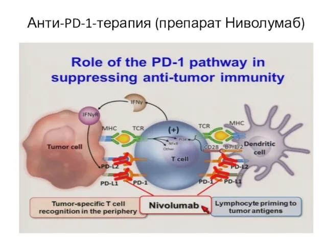 Анти-PD-1-терапия (препарат Ниволумаб)