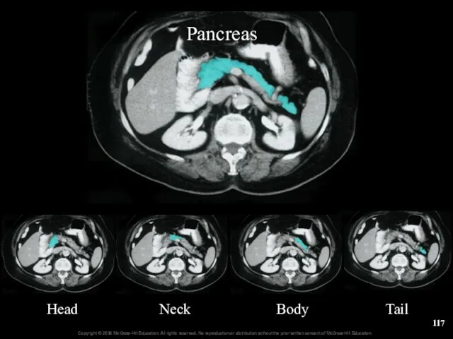 Pancreas Head Neck Body Tail