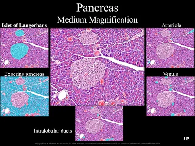 Pancreas Medium Magnification Islet of Langerhans Exocrine pancreas Arteriole Venule Intralobular ducts