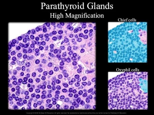 Parathyroid Glands High Magnification Chief cells Oxyphil cells