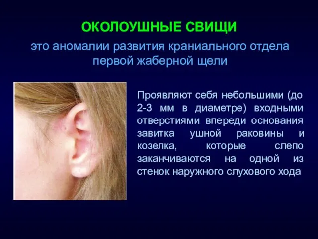 ОКОЛОУШНЫЕ СВИЩИ Проявляют себя небольшими (до 2-3 мм в диаметре) входными