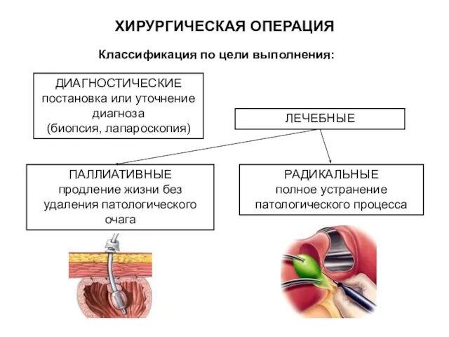 Классификация по цели выполнения: ДИАГНОСТИЧЕСКИЕ постановка или уточнение диагноза (биопсия, лапароскопия)