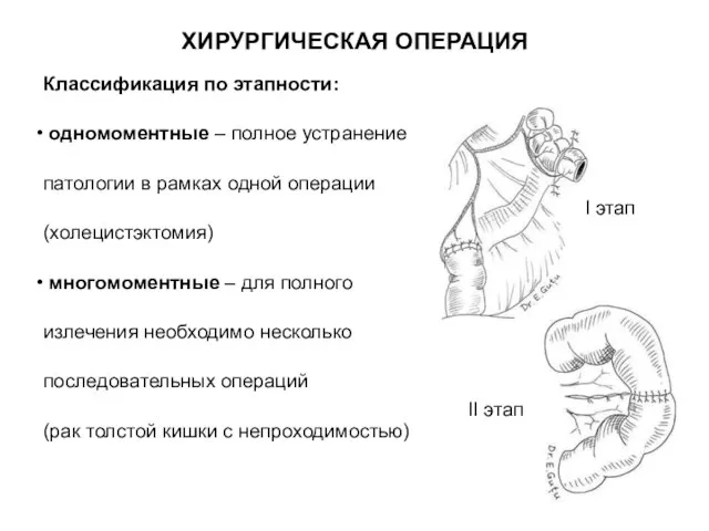 Классификация по этапности: одномоментные – полное устранение патологии в рамках одной