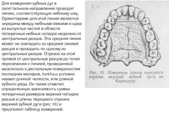 Для измерения зубных дуг в сагиттальном направлении проводят линию, соответствующую небному