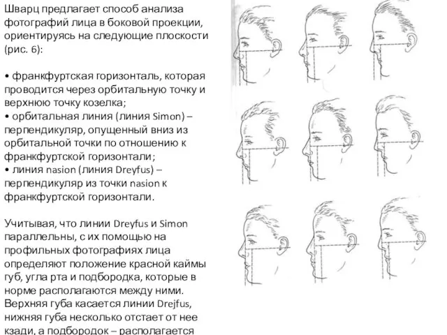 Шварц предлагает способ анализа фотографий лица в боковой проекции, ориентируясь на