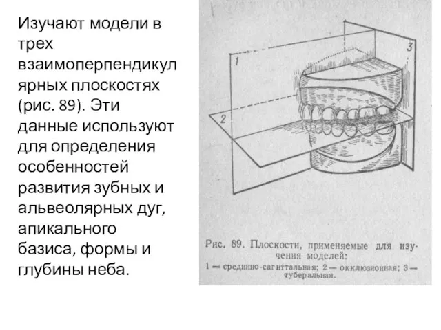 Изучают модели в трех взаимоперпендикулярных плоскостях (рис. 89). Эти данные используют