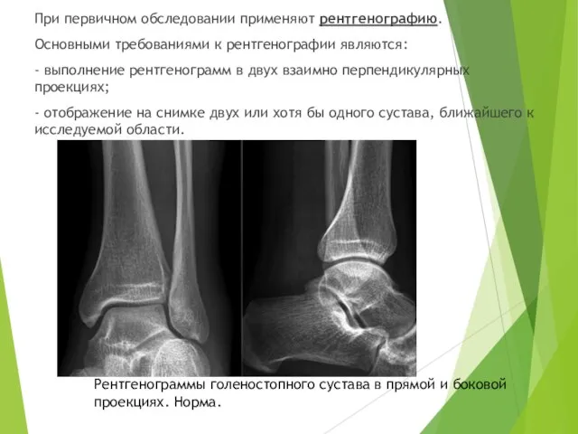 При первичном обследовании применяют рентгенографию. Основными требованиями к рентгенографии являются: -