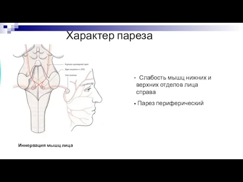 Характер пареза Иннервация мышц лица Слабость мышц нижних и верхних отделов лица справа Парез периферический