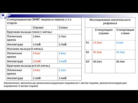 Заключение: аксонально-демиелинизирующее поражение II ветви справа, демиелинизирующее поражение III ветви справа