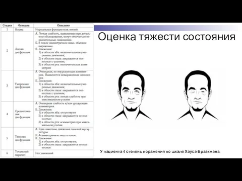 Оценка тяжести состояния У пациента 4 степень поражения по шкале Хауса-Браакмана.