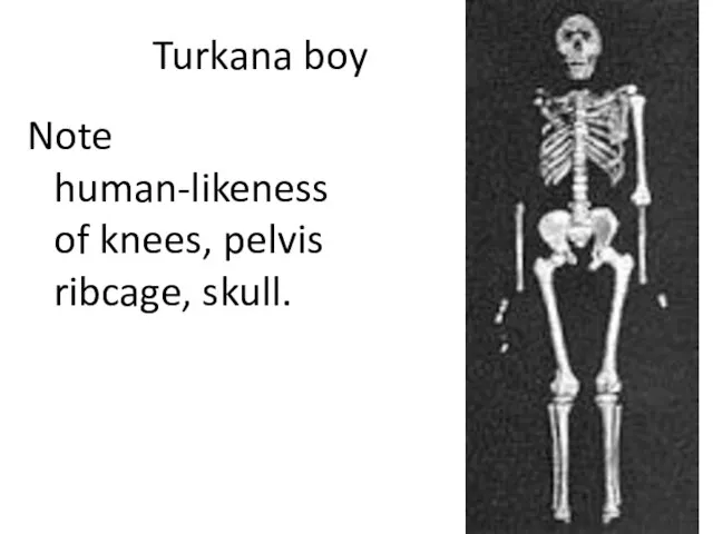 Turkana boy Note human-likeness of knees, pelvis ribcage, skull.