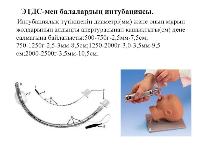 ЭТДС-мен балалардың интубациясы. Интубациялық түтікшенің диаметрі(мм) және оның мұрын жолдарының алдыңғы