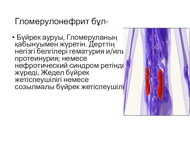 Гломерулонефрит бұл- Бүйрек ауруы, Гломеруланың қабынуымен жүретін. Дерттің негізгі белгілері гематурия