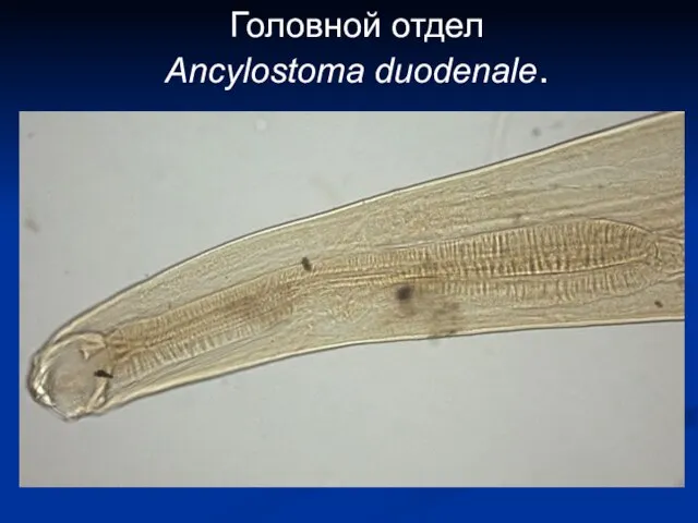 Головной отдел Ancylostoma duodenale.