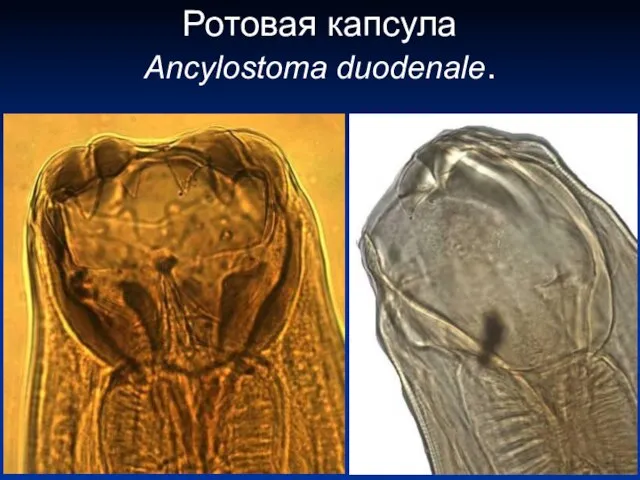 Ротовая капсула Ancylostoma duodenale.