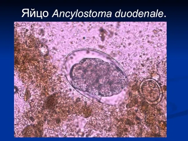 Яйцо Ancylostoma duodenale.