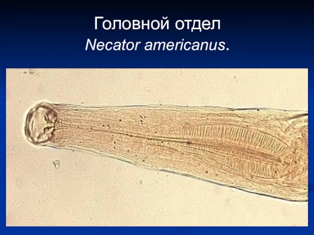 Головной отдел Necator americanus.