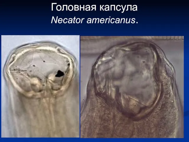 Головная капсула Necator americanus.