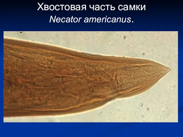 Хвостовая часть самки Necator americanus.