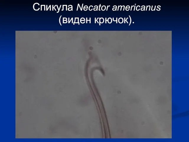 Спикула Necator americanus (виден крючок).