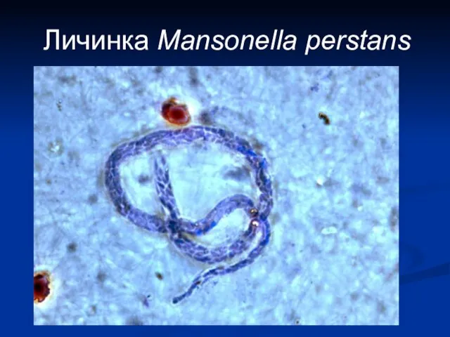 Личинка Mansonella perstans