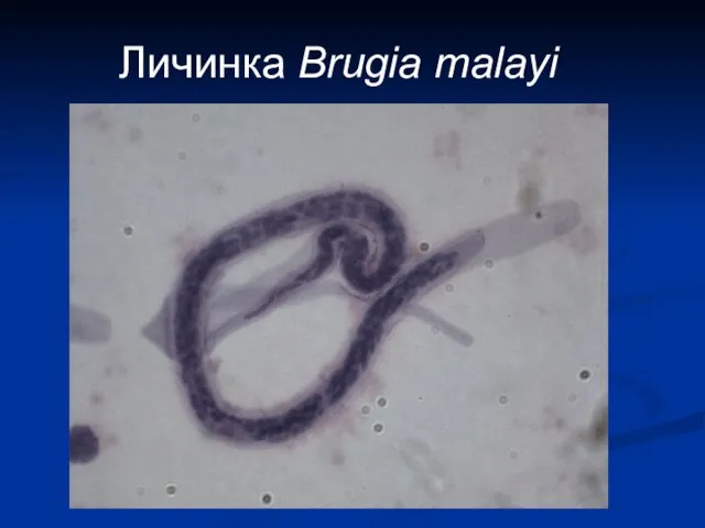 Личинка Brugia malayi