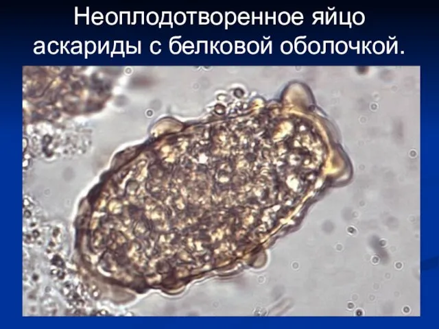 Неоплодотворенное яйцо аскариды с белковой оболочкой.