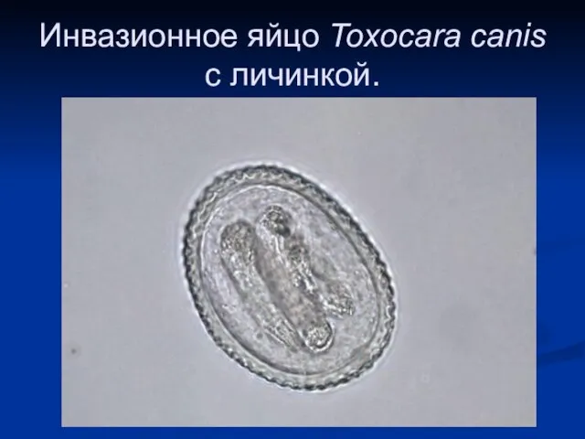 Инвазионное яйцо Toxocara canis с личинкой.