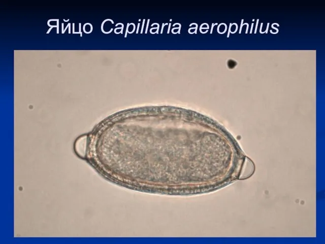 Яйцо Сapillaria aerophilus