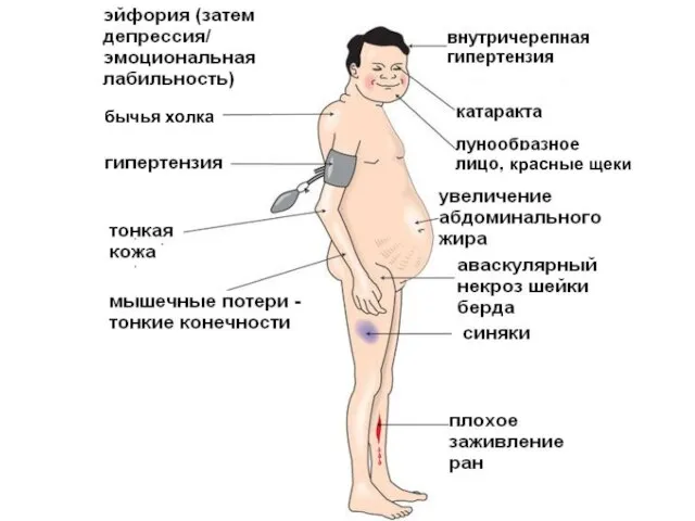 бычья холка красные щеки