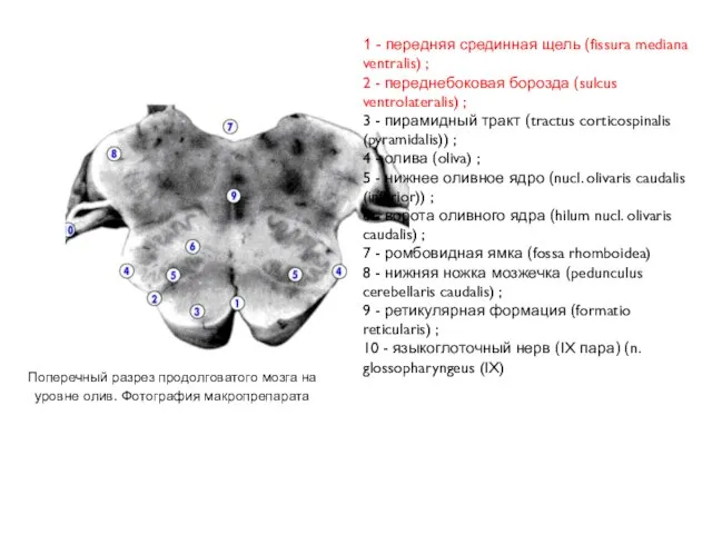 1 - передняя срединная щель (fissura mediana ventralis) ; 2 -