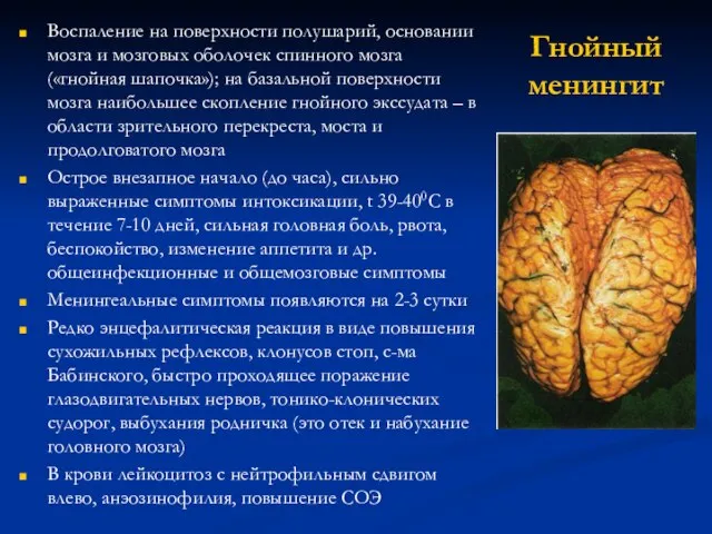 Гнойный менингит Воспаление на поверхности полушарий, основании мозга и мозговых оболочек