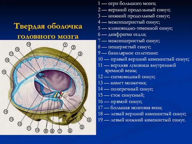 Твердая оболочка головного мозга 1 — серп большого мозга; 2 —