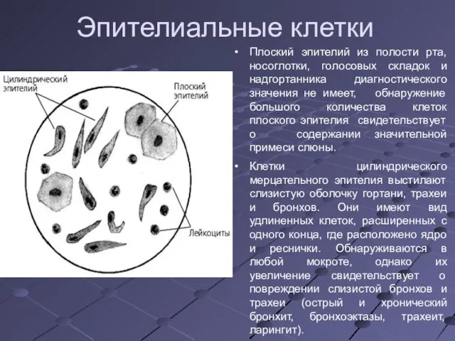 Эпителиальные клетки Плоский эпителий из полости рта, носоглотки, голосовых складок и