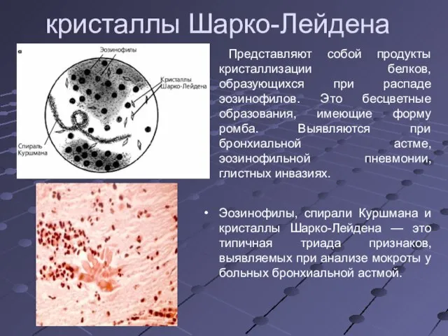 кристаллы Шарко-Лейдена Представляют собой продукты кристаллизации белков, образующихся при распаде эозинофилов.