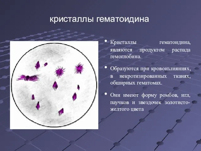 кристаллы гематоидина Кристаллы гематоидина, являются продуктом распада гемоглобина. Образуются при кровоизлияниях,