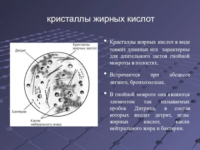 кристаллы жирных кислот Кристаллы жирных кислот в виде тонких длинных игл