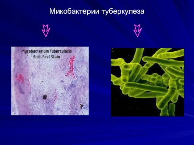 Микобактерии туберкулеза