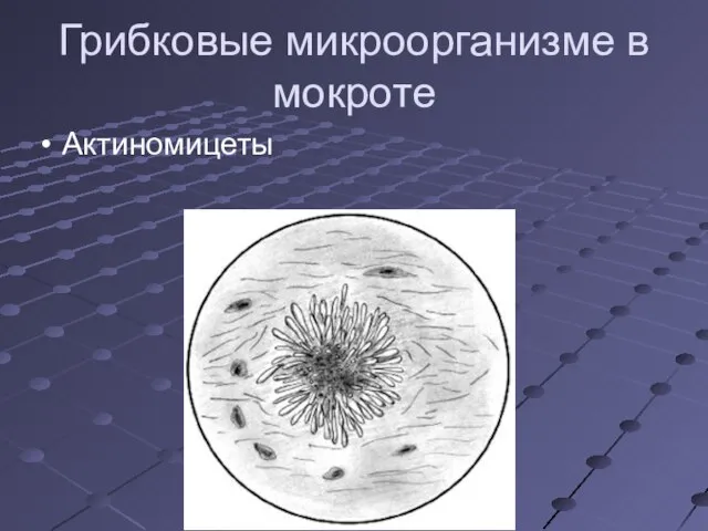 Грибковые микроорганизме в мокроте Актиномицеты