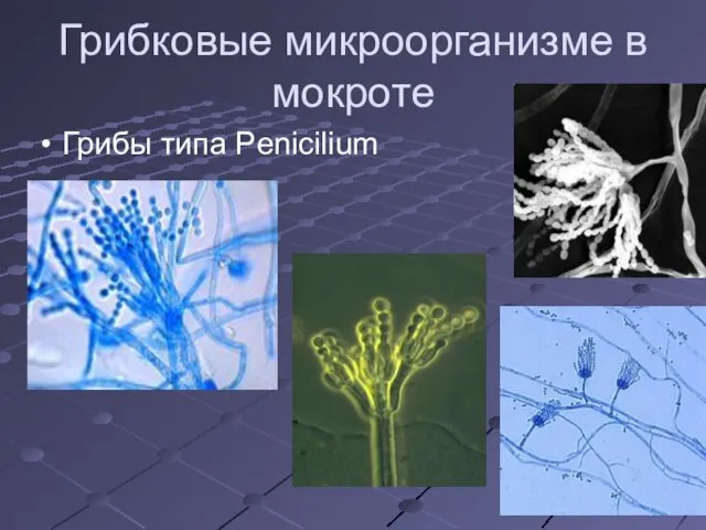 Грибковые микроорганизме в мокроте Грибы типа Penicilium