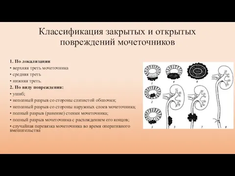 Классификация закрытых и открытых повреждений мочеточников 1. По локализации • верхняя