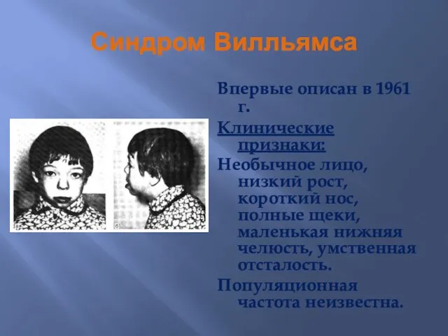 Синдром Вилльямса Впервые описан в 1961 г. Клинические признаки: Необычное лицо,