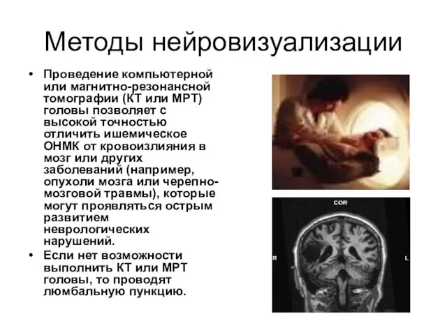 Методы нейровизуализации Проведение компьютерной или магнитно-резонансной томографии (КТ или МРТ) головы