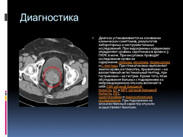 Диагностика Диагноз устанавливается на основании клинических симптомов, результатов лабораторных и инструментальных