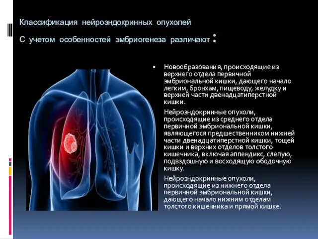 Классификация нейроэндокринных опухолей С учетом особенностей эмбриогенеза различают: Новообразования, происходящие из