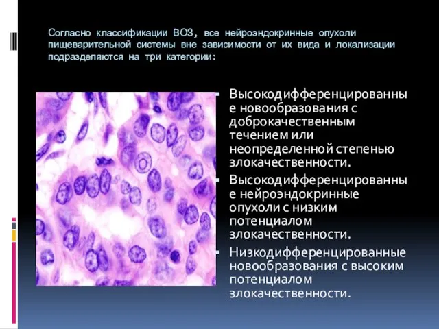 Согласно классификации ВОЗ, все нейроэндокринные опухоли пищеварительной системы вне зависимости от