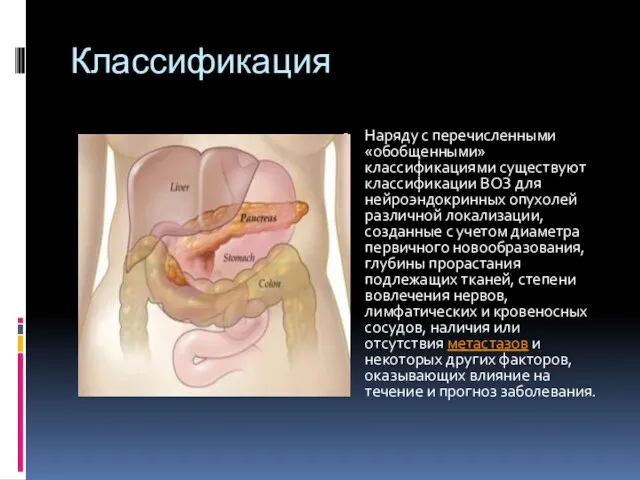 Классификация Наряду с перечисленными «обобщенными» классификациями существуют классификации ВОЗ для нейроэндокринных